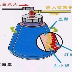 �x��ʽѪҺ�ɷַ��x�O(sh��)���R���u�rע�Լ��g(sh��)����ָ��(d��o)ԭ�t